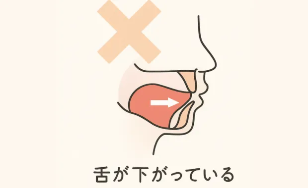 低位舌の舌の位置