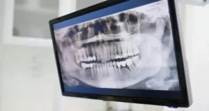 SPTで行う主な内容