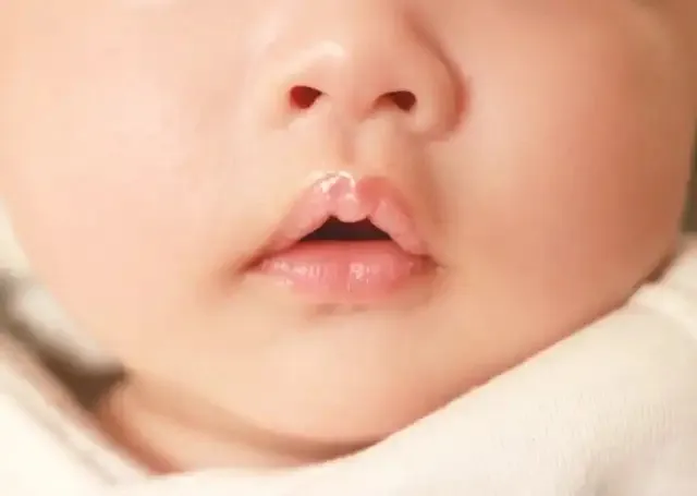 お口ぽかんしている様子