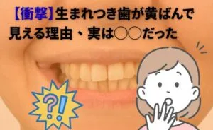 【衝撃】生まれつき歯が黄ばんで見える理由、実は◯◯だった!